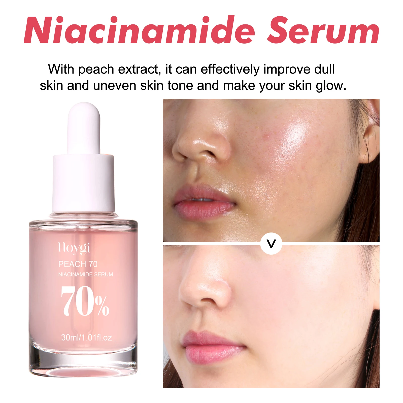 Hoygi Niacinamide Face Serum — angle 5, free shipping at JEHORIZON